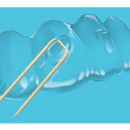 Исправление прикуса на элайнерах Spark™