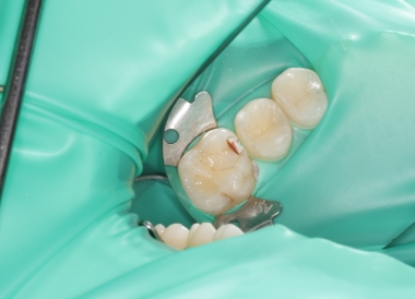 Лечение зубов и десен 1