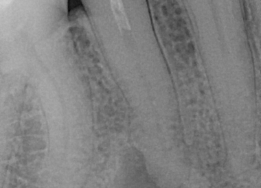 Лечение зубов и десен 8
