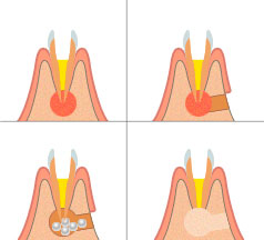 Хирургия в стоматологии